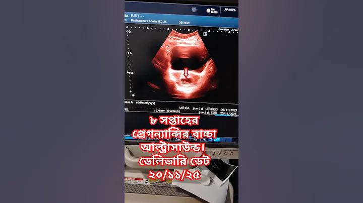 আরজেন আর্জেন্টিনার আজকের খেলা লাইভ