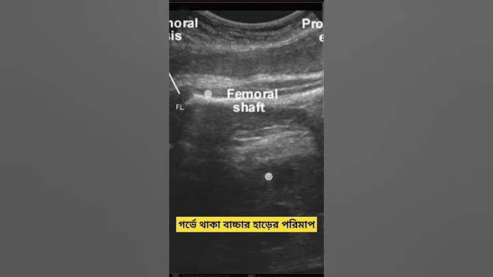 কোথাও যদি হারিয়ে আমি
