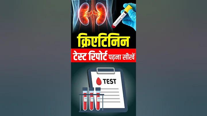 বাংলাদেশে Mostbet আইপিএল বেটিং: ক্রিকেট লিগের সবচেয়ে বড়