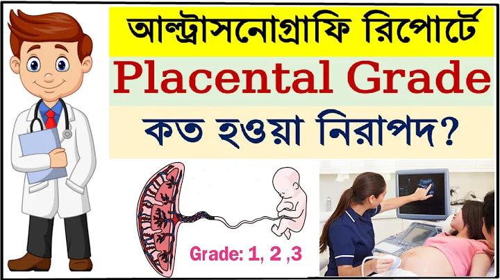 ৩ সংখ্যার শেষের সাথে ১ নম্বর পুরস্কার পেলে টাকা পাবেন কিনা